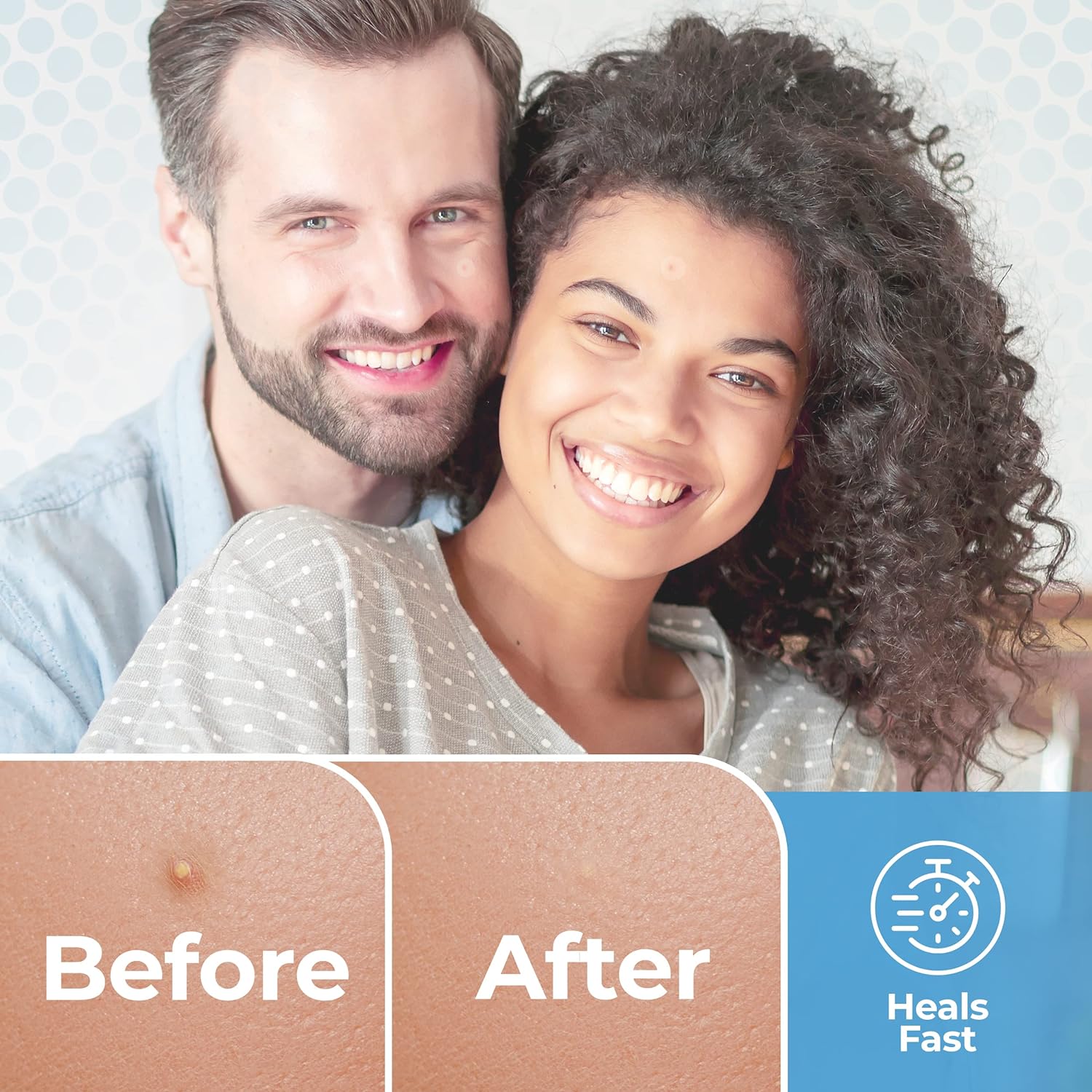 Basic Concepts 100% All-Natural Pimple & Blemish Patches (120 PACK)